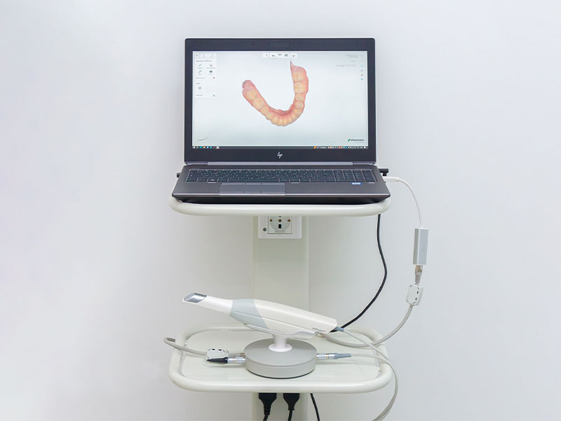 Postazione con scanner intraorale 3D
