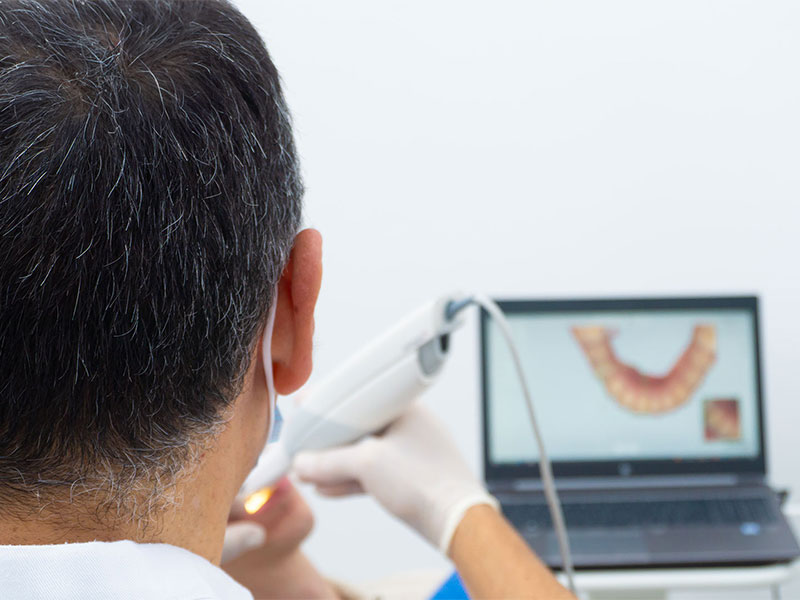 Dentista con scanner intraorale 